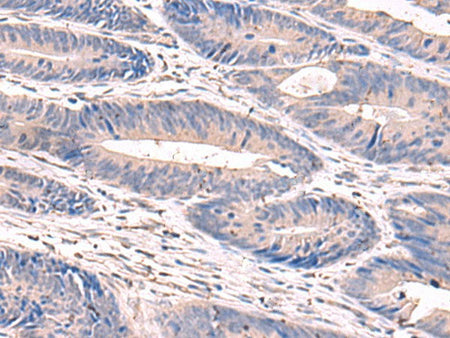 GKAP1 Polyclonal Antibody Reactivity Human