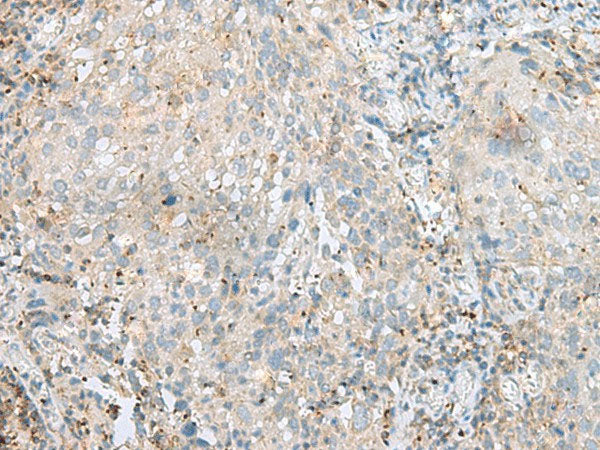 SEPT1 Polyclonal Antibody Reactivity Human