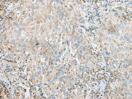 SEPT1 Polyclonal Antibody Reactivity Human