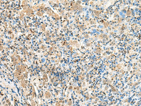 SNAPC1 Polyclonal Antibody Reactivity Human