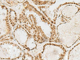 SNAPC1 Polyclonal Antibody Reactivity Human
