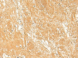 STK32C Polyclonal Antibody Reactivity Human