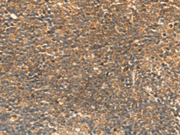 STK32C Polyclonal Antibody Reactivity Human