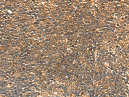 STK32C Polyclonal Antibody Reactivity Human