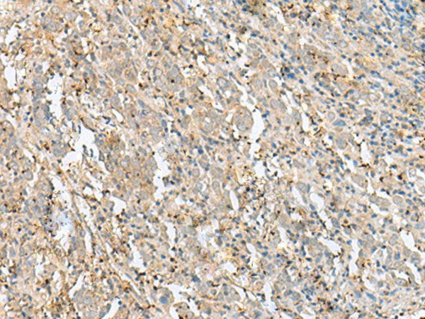 FLOT2 Polyclonal Antibody Reactivity Human