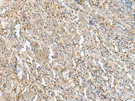 FLOT2 Polyclonal Antibody Reactivity Human
