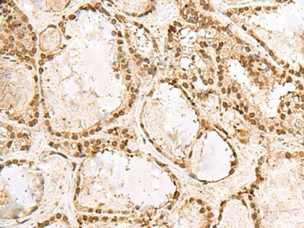 KRR1 Polyclonal Antibody Reactivity Human