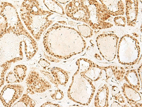 PSPC1 Polyclonal Antibody Reactivity Human