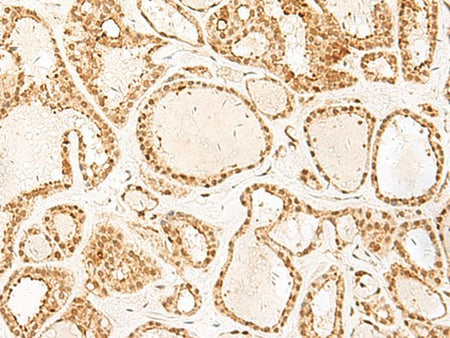 PSPC1 Polyclonal Antibody Reactivity Human