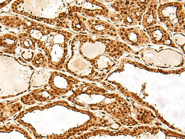 ADRM1 Polyclonal Antibody Reactivity Human