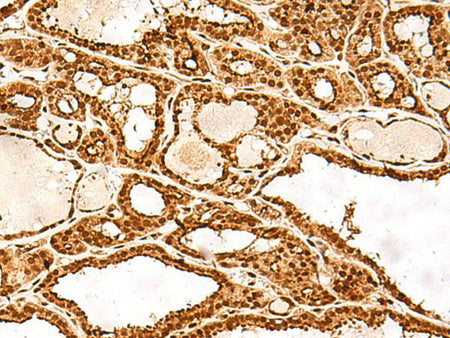 ADRM1 Polyclonal Antibody Reactivity Human