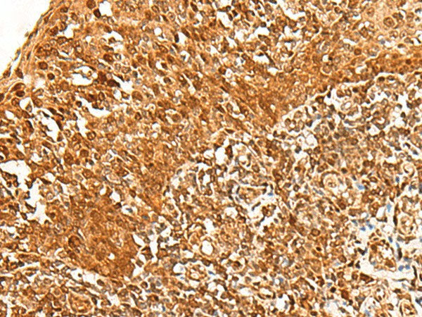 ADRM1 Polyclonal Antibody Reactivity Human