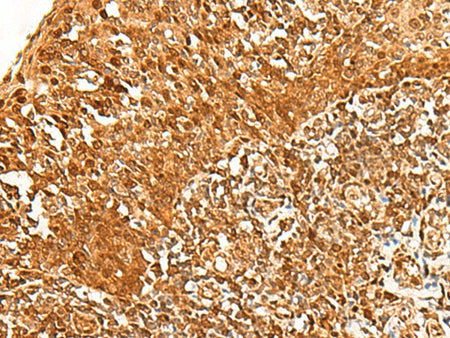 ADRM1 Polyclonal Antibody Reactivity Human