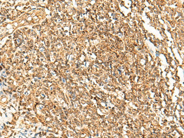 POLH Polyclonal Antibody Reactivity Human