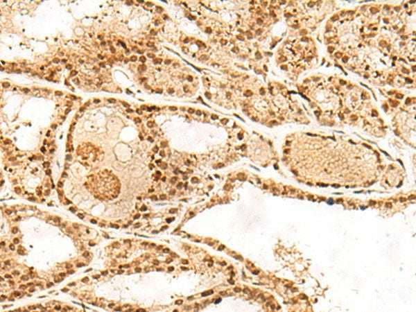POLH Polyclonal Antibody Reactivity Human