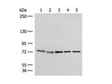 POLH Polyclonal Antibody Reactivity Human