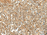 POLR1E Polyclonal Antibody Reactivity Human