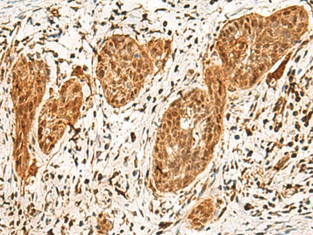POLR1E Polyclonal Antibody Reactivity Human