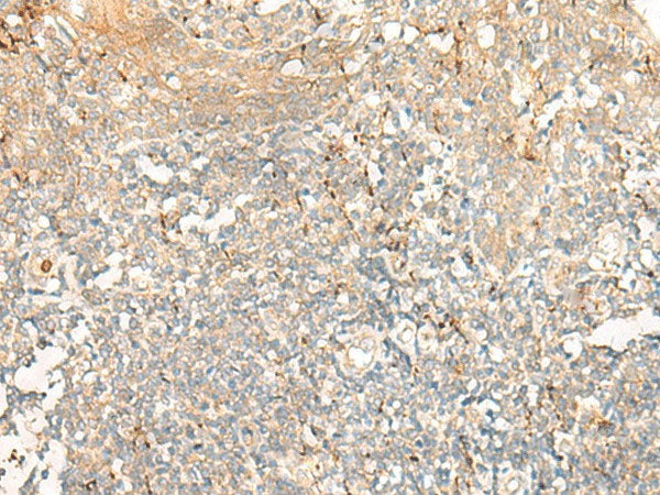 GCAT Polyclonal Antibody Reactivity Human