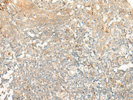 GCAT Polyclonal Antibody Reactivity Human