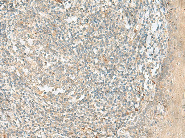TTLL1 Polyclonal Antibody Reactivity Human