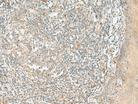 TTLL1 Polyclonal Antibody Reactivity Human