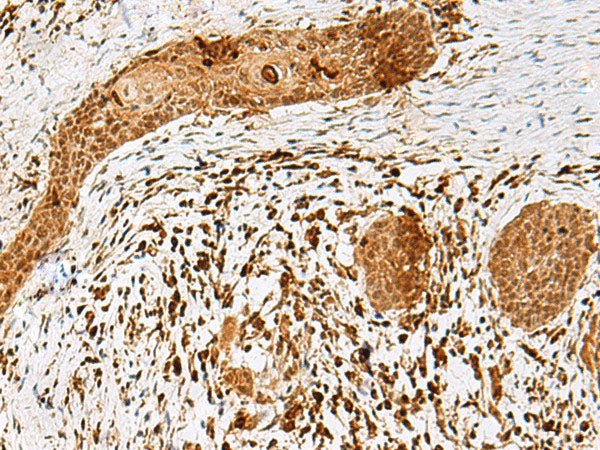 SCRN2 Polyclonal Antibody Reactivity Human