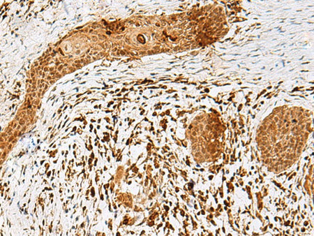 SCRN2 Polyclonal Antibody Reactivity Human