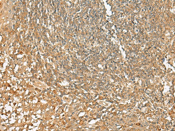 SCRN2 Polyclonal Antibody Reactivity Human