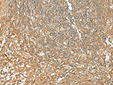 SCRN2 Polyclonal Antibody Reactivity Human