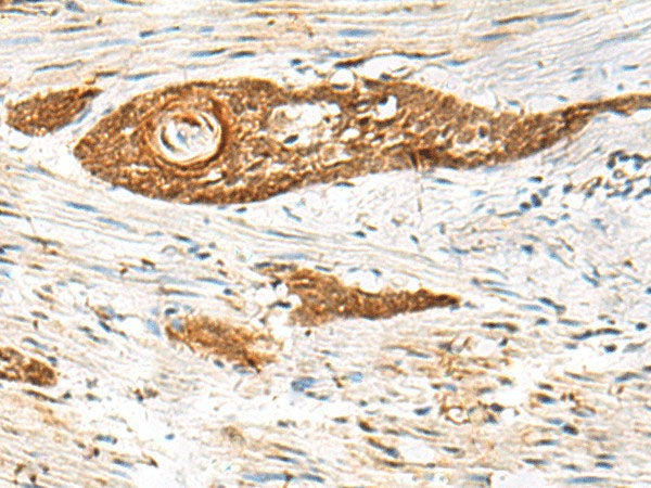 GPSM1 Polyclonal Antibody Reactivity Human