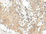 GPSM1 Polyclonal Antibody Reactivity Human