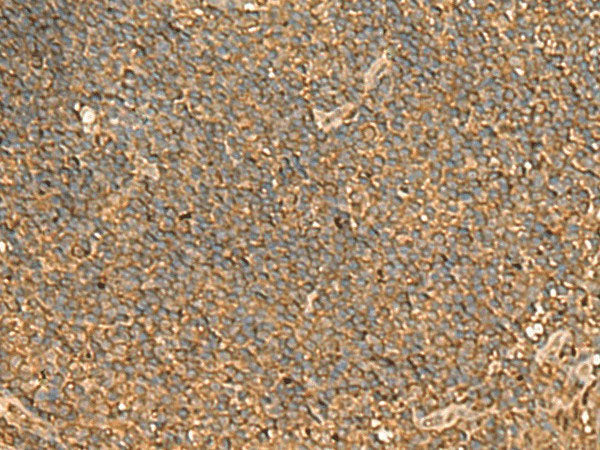 ENO3 Polyclonal Antibody Reactivity Human