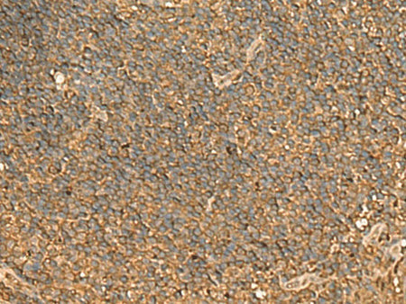 ENO3 Polyclonal Antibody Reactivity Human