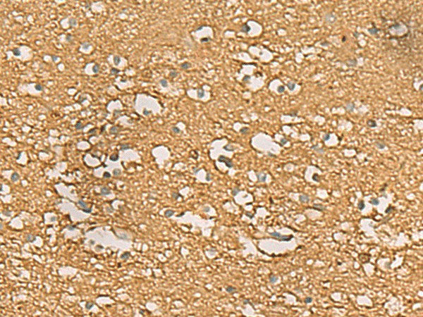 ENO3 Polyclonal Antibody Reactivity Human