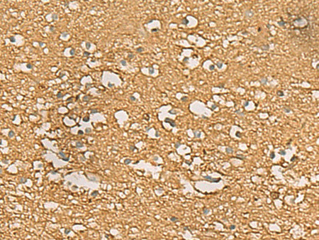 ENO3 Polyclonal Antibody Reactivity Human