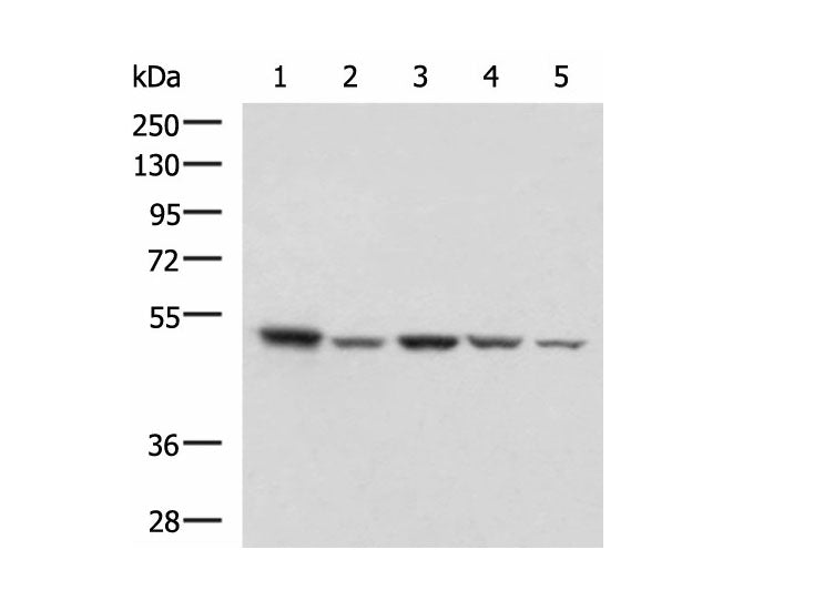 ENO3 Polyclonal Antibody Reactivity Human