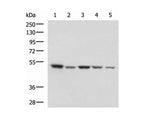 ENO3 Polyclonal Antibody Reactivity Human
