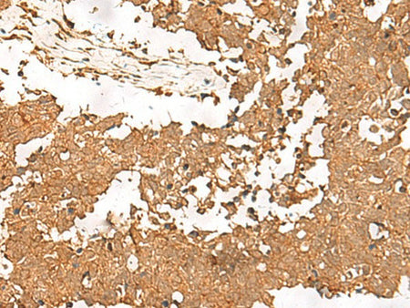 SMOC1 Polyclonal Antibody Reactivity Human