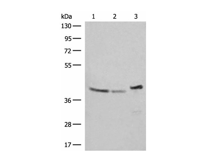 ERAL1 Polyclonal Antibody Reactivity Human