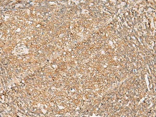 FNTB Polyclonal Antibody Reactivity Human