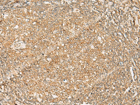 FNTB Polyclonal Antibody Reactivity Human