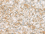 TLE6 Polyclonal Antibody