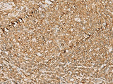 PSMD12 Polyclonal Antibody Reactivity Human