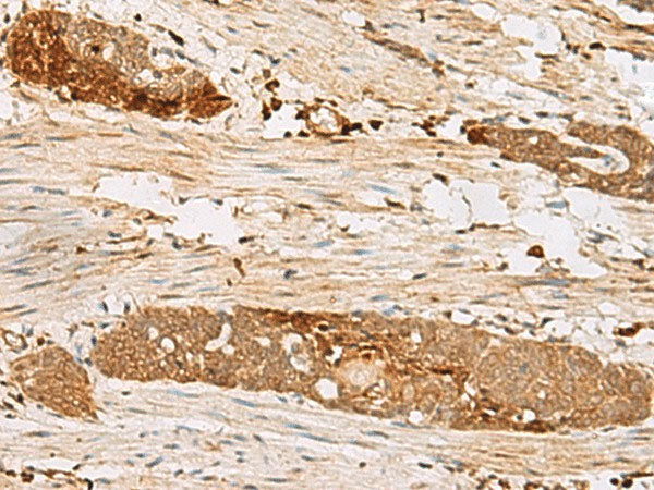 PSMD12 Polyclonal Antibody Reactivity Human