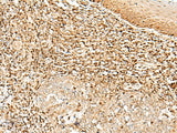 DNPEP Polyclonal Antibody Reactivity Human