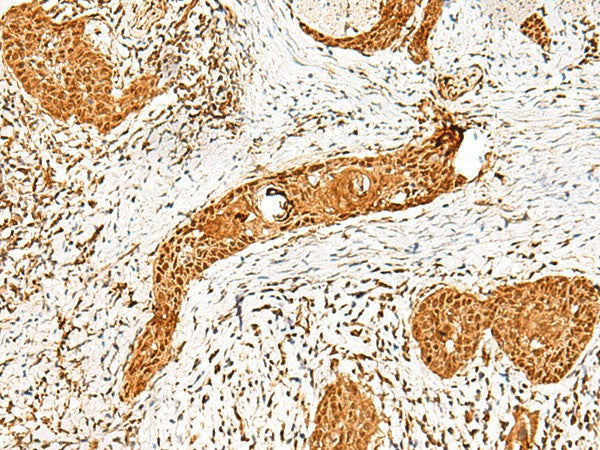 PPOX Polyclonal Antibody Reactivity Human