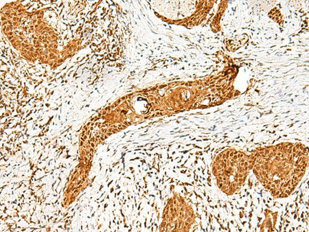 PPOX Polyclonal Antibody Reactivity Human