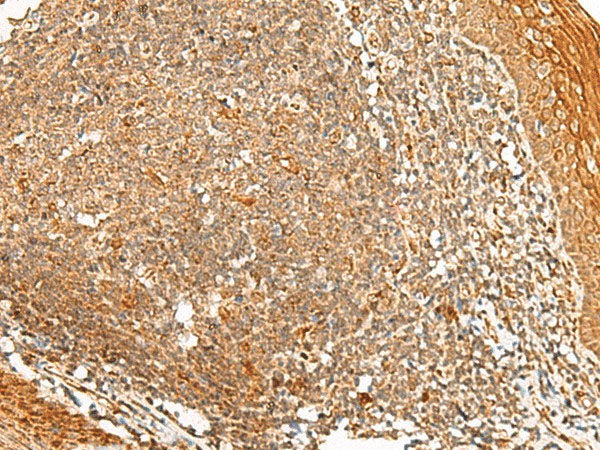 PPOX Polyclonal Antibody Reactivity Human