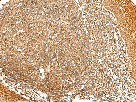 PPOX Polyclonal Antibody Reactivity Human